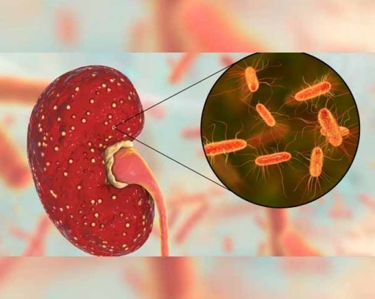 La investigación argentina para tratar al Síndrome Urémico Hemolítico comienza en Europa su última fase
