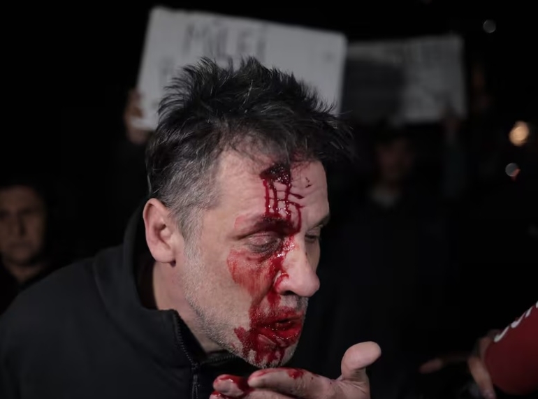 Un periodista fue herido en las inmediaciones del acto de Milei en Moreno